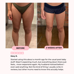 Mireva Fit™ Thigh & Pelvic Trainer